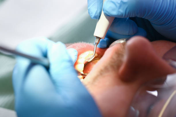 Best After-Hours Emergency Dentist in Iceville, AL
