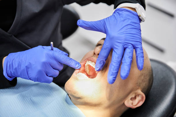 Best Emergency Tooth Extraction in Iceville, AL